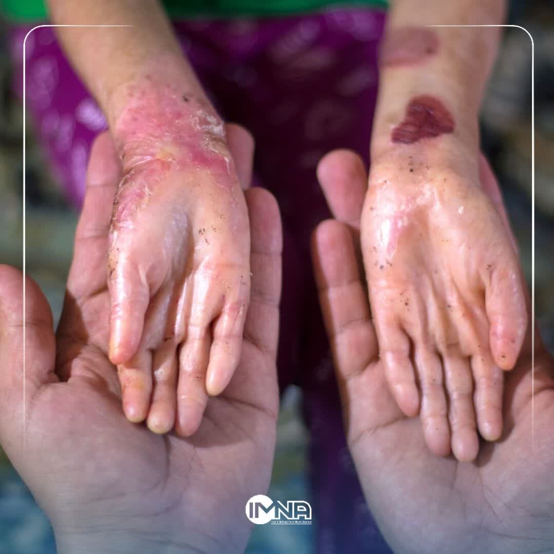 از گامهای موثر برای دستیابی به تولید برق هستهای تا افزایش حقوق کارورزان و دستیاران پزشکی