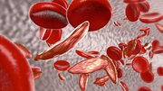 خدمات حیاتی انتقال خون به ۸۶۵ بیمار تالاسمی در استان اصفهان/تولید ۳ فراورده از هر واحد خون
