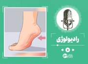 چگونه در خانه ترک پا را درمان کنیم؟