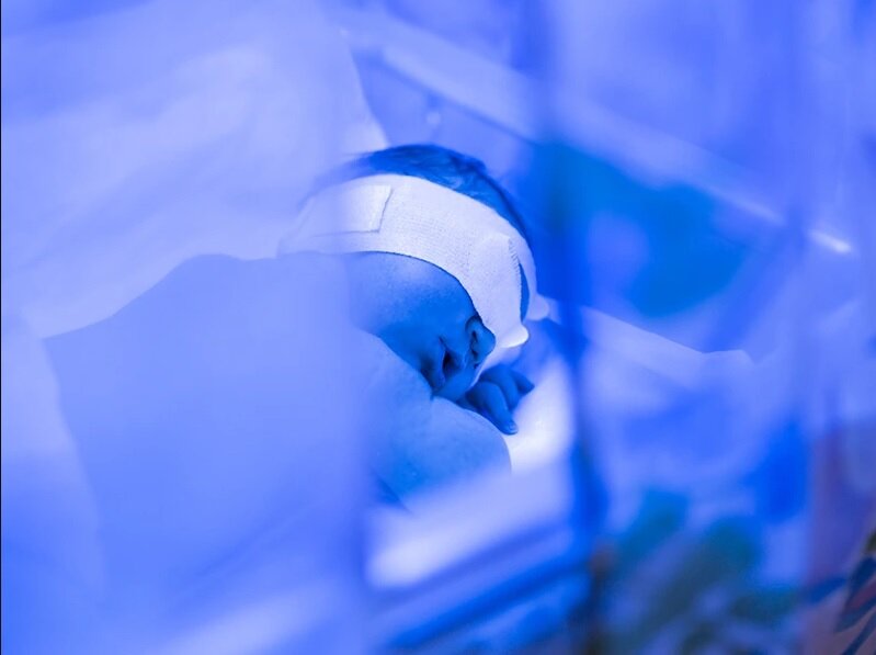 نوزاد زیر دستگاه زردی