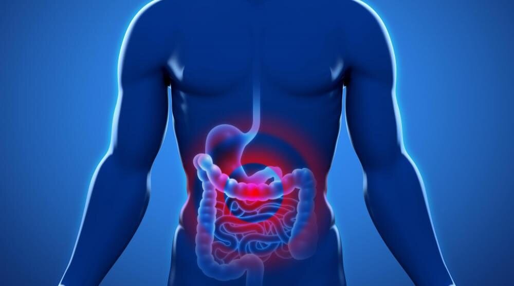 سرطان روده؛ معمای ژنتیک یا خطای سبک زندگی؟