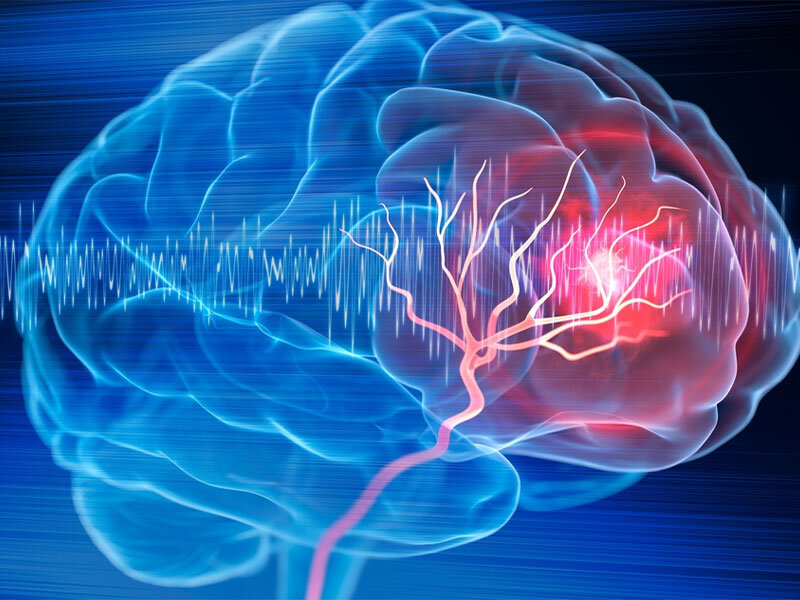 تهدید حیات سلولهای مغزی