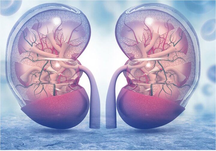 تغذیه هدفمند در بیماران کلیوی؛ از پیشگیری تا بهبود عملکرد کلیه