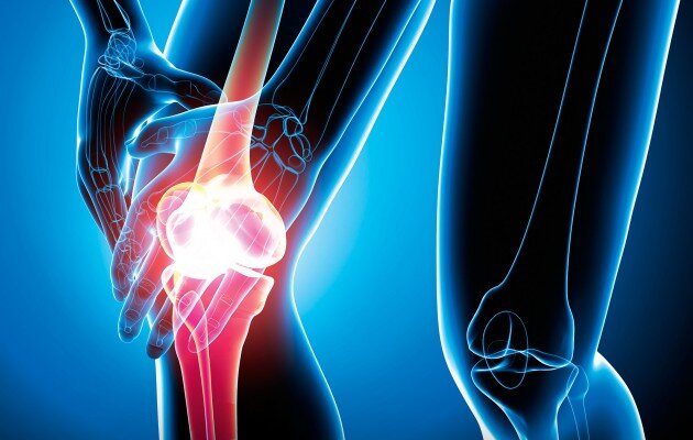 حفظ سلامت زانو در گرو کنترل بیماری‌ها و رعایت اصول صحیح زندگی