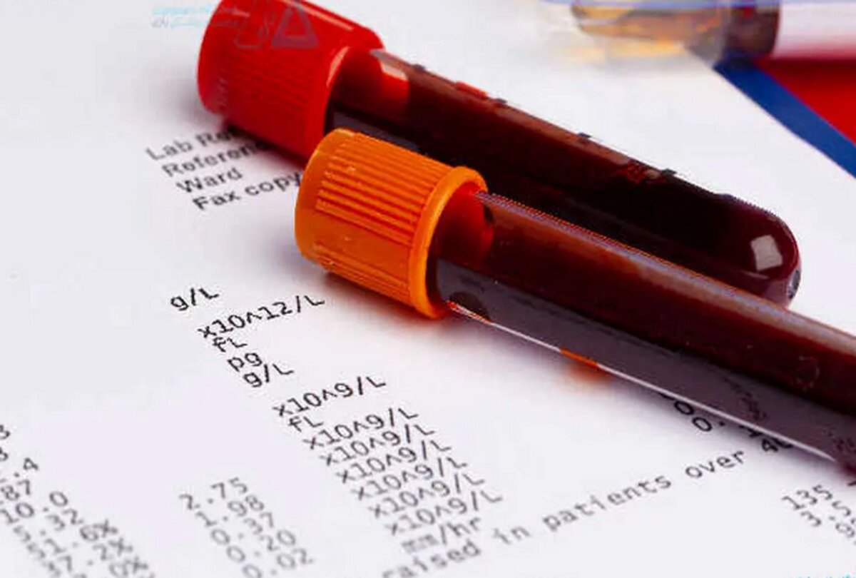 آزمایش خون؛ ابزاری برای رمزگشایی بیماریها