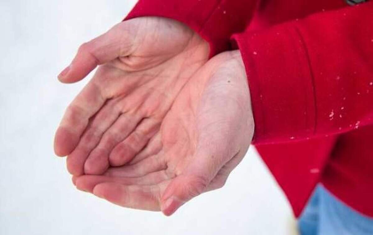 سرمازدگی و آسیبهای آن + راهکار پیشگیری و درمان سرمازدگی