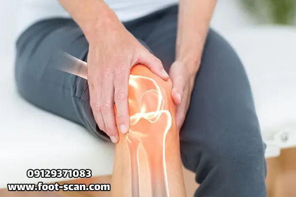 آرتروز زانو چه علائمی دارد؟