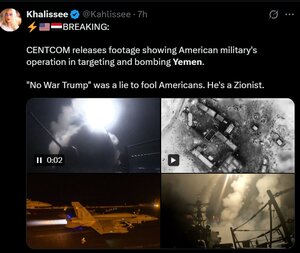 خون کودکان یمن بر دستان ترامپ