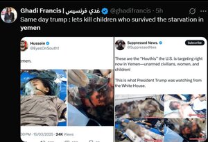 خون کودکان یمن بر دستان ترامپ