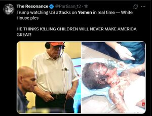 خون کودکان یمن بر دستان ترامپ