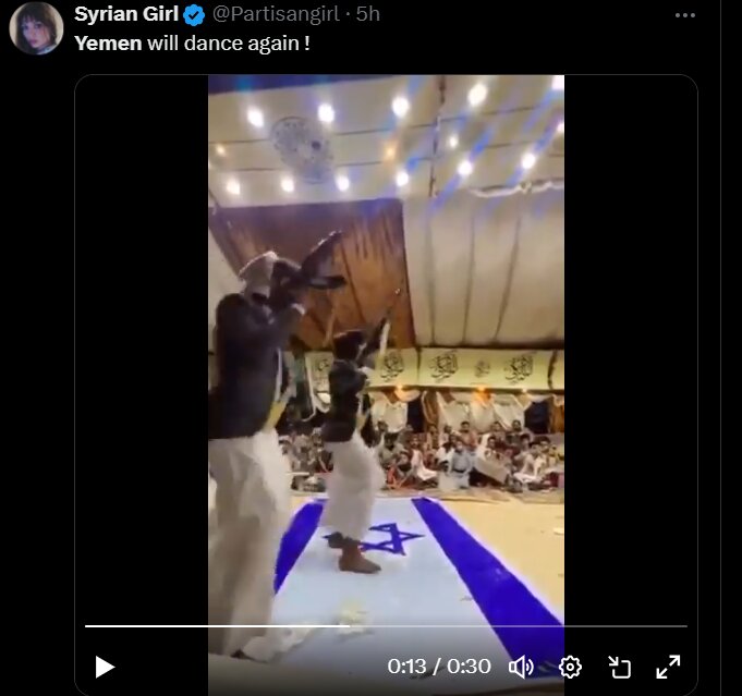 خون کودکان یمن بر دستان ترامپ