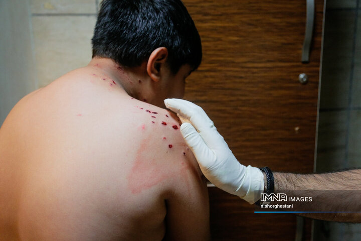 آسیب دیدگان شب چهارشنبه سوری