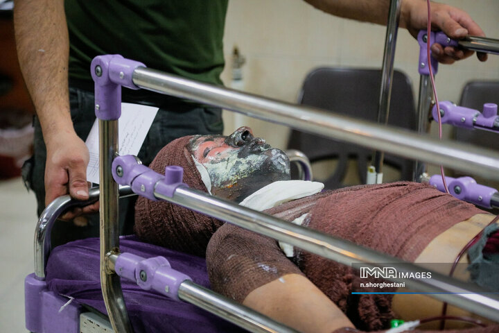 آسیب دیدگان شب چهارشنبه سوری