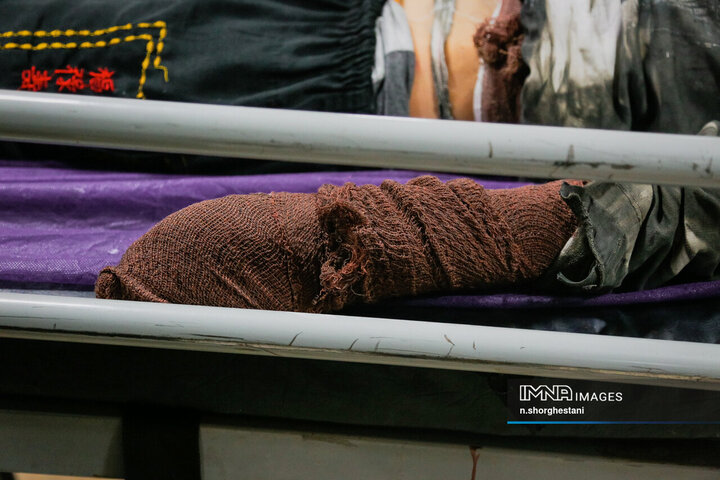 آسیب دیدگان شب چهارشنبه سوری