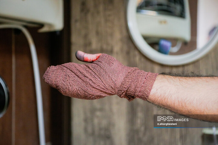 آسیب دیدگان شب چهارشنبه سوری