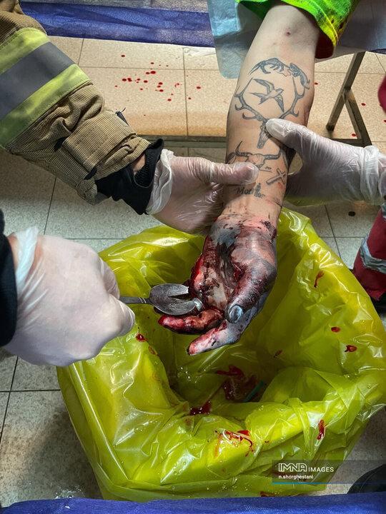 آسیب دیدگان شب چهارشنبه سوری