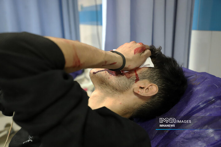 مصدومان شب چهارشنبه سوری