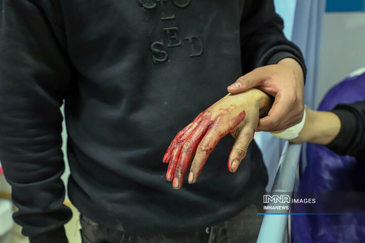 مصدومان شب چهارشنبه سوری