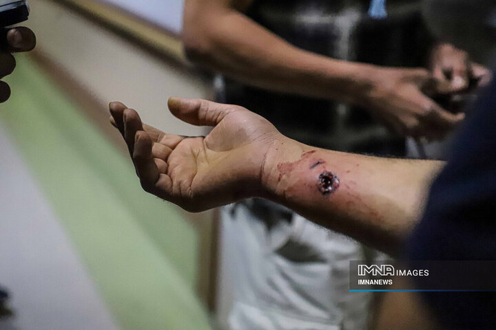 مصدومان شب چهارشنبه سوری