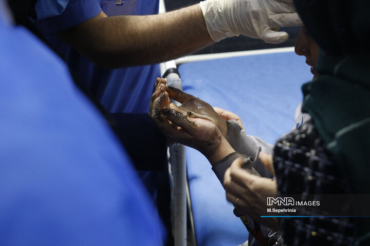 مصدومان شب چهارشنبه سوری