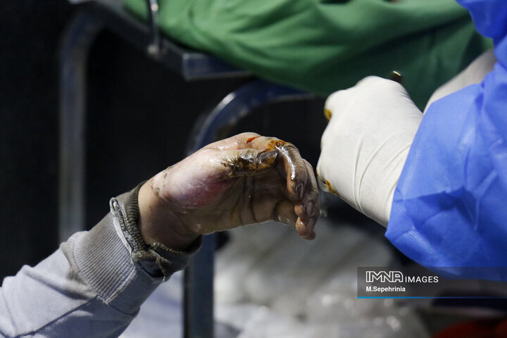 مصدومان شب چهارشنبه سوری