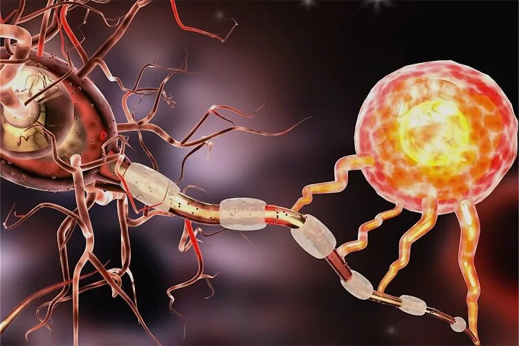 نقش پررنگ تشخیص زودهنگام و استمرار درمان در کنترل بیماری ام اس