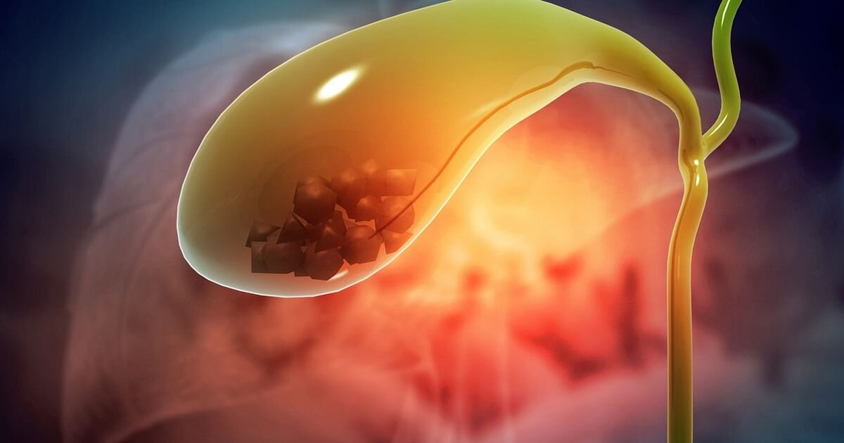 کارکرد صفرا و بیماری‌های خاموش آن