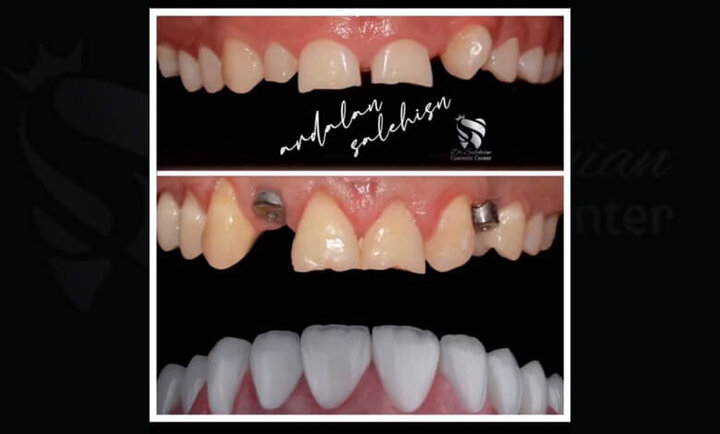 خدمات تخصصی دندانپزشکی زیبایی با دکتر صالحیان