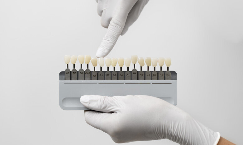 کامپوزیت دندان