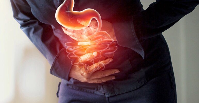 زنگ خطر علائم پنهان سرطان معده