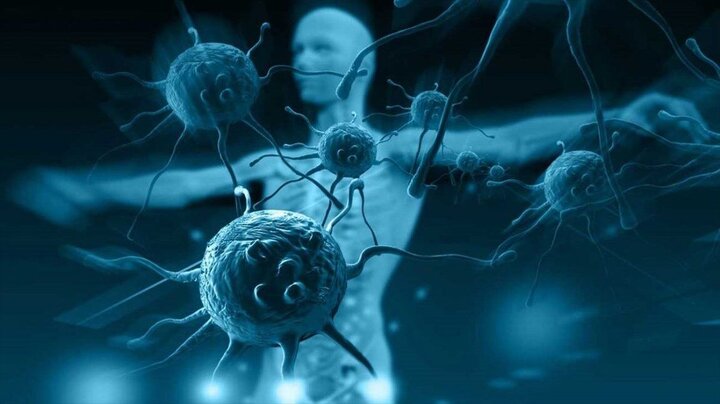 در حصار واکنشی غیرعادی