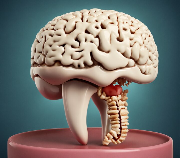 نتیجه مثبت داروی آلزایمر لکانمب در بیماران خارج از کارآزمایی بالینی
