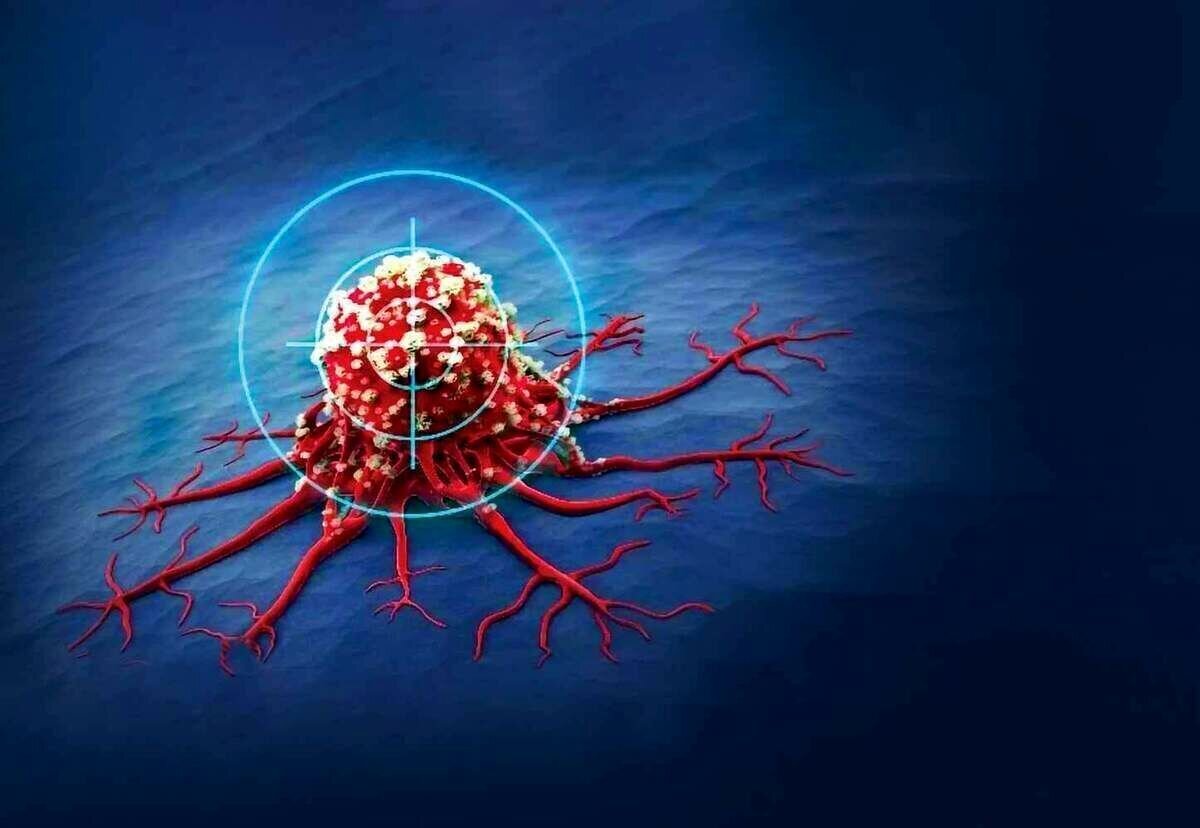 نشانه‌های پنهان سرطان در مردان