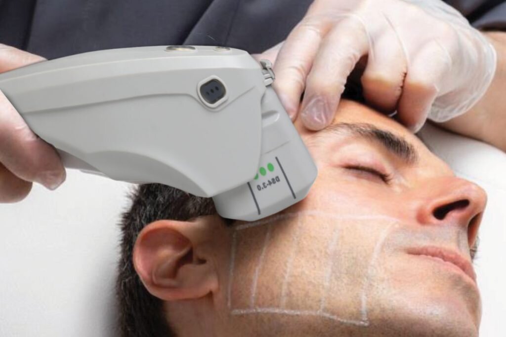 هایفو تراپی 