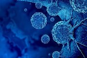 تومورهای پوستی؛ چهره‌ای پنهان از بیماری