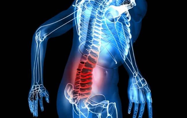 هشدارهای ستون فقرات که باید جدی گرفته شود