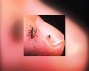 شناسایی ۳ بیمار قطعی مبتلا به تب کریمه کنگو در اردبیل