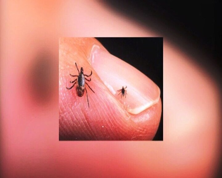 شناسایی ۳ بیمار قطعی مبتلا به تب کریمه کنگو در اردبیل