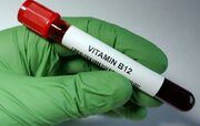 کمبود B۱۲ چه علائم و چه عوارضی دارد؟