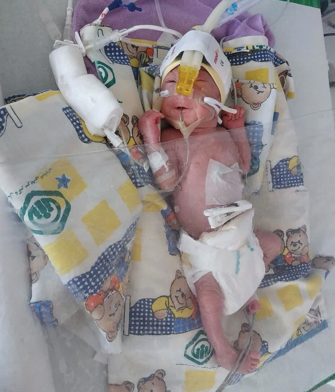 تولد معجزهای کوچک در بخش NICU بیمارستان شریعتی اصفهان
