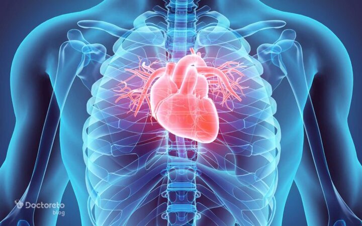 تعویض دریچه قلب بدون جراحی باز در همدان