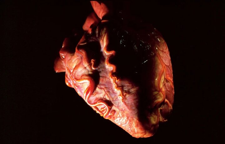 راهی نوین برای نجات جان بیماران