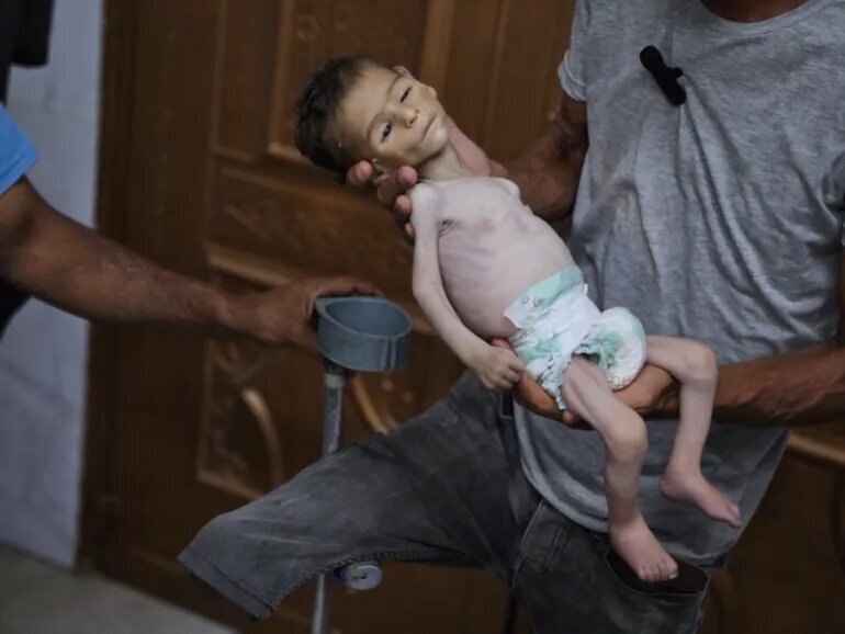 چگونه به گرسنگان غزه کمک کنیم؟ راهنمای جامع کمکرسانی به مردم مظلوم غزه