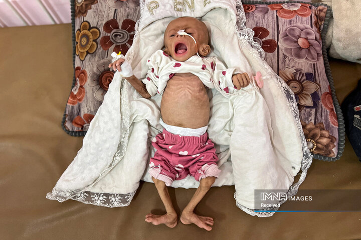 فاجعه انسانی در غزه