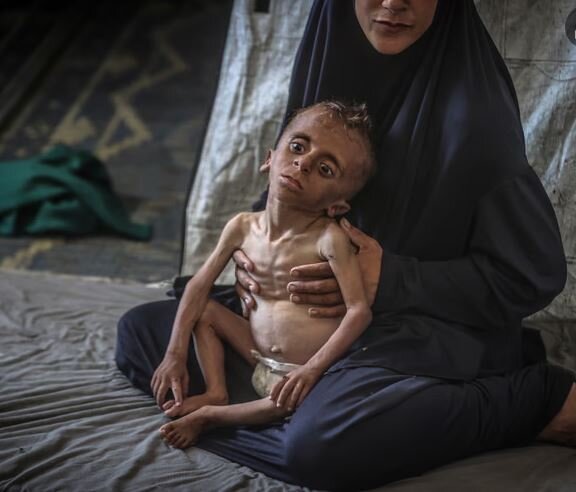 تراژدی مرگهای ناشی از گرسنگی در غزه به سطح فاجعه اخلاقی رسید