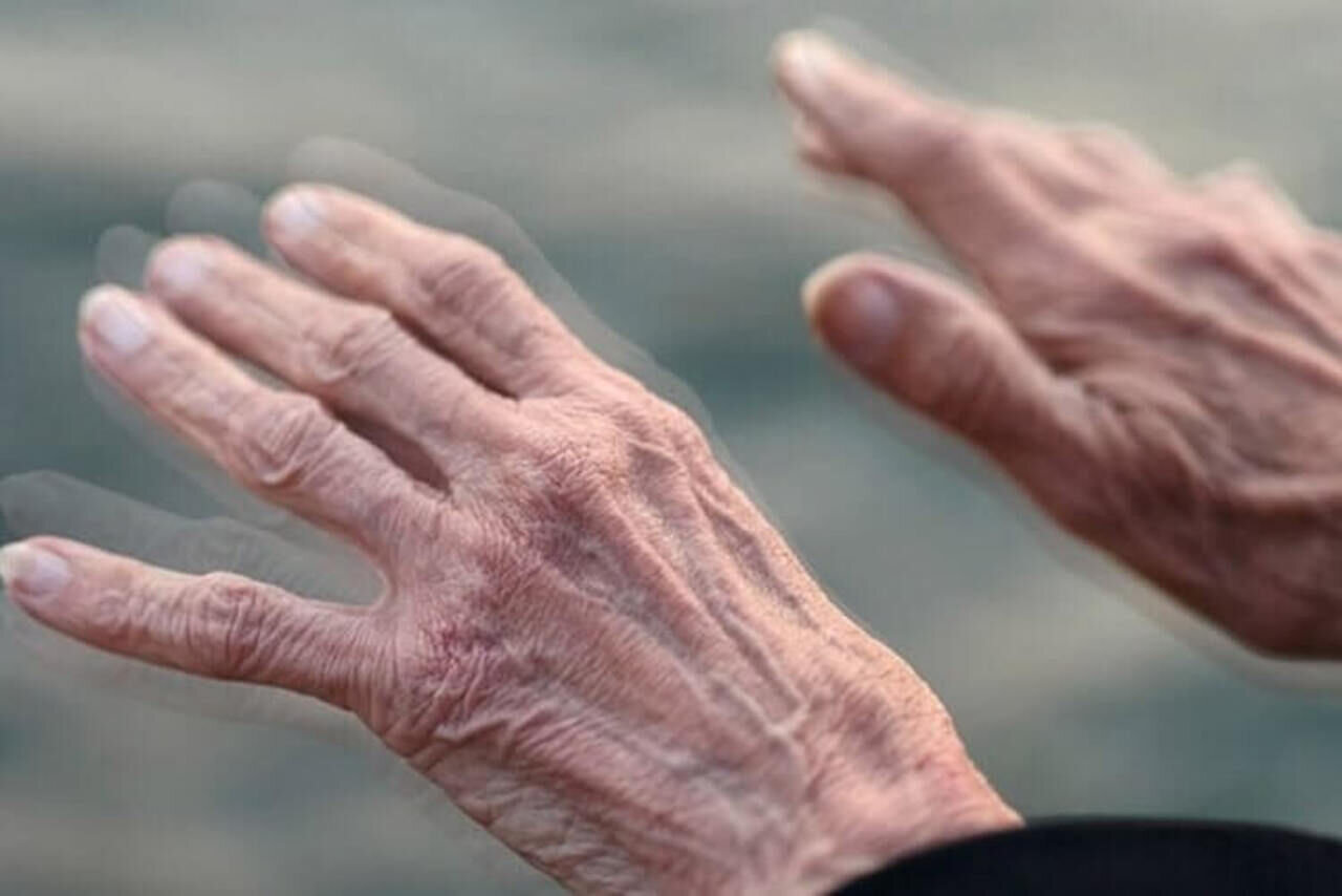 زندگی با پارکینسون؛ نبردی با پیچیدگیهای بیماری