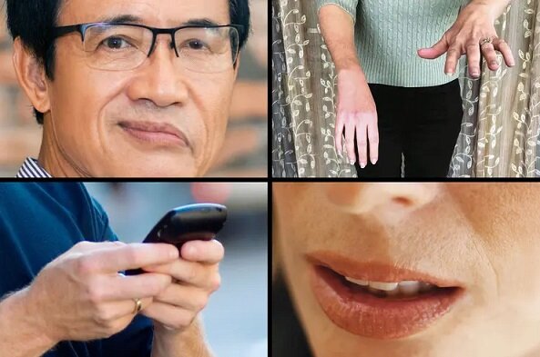 برای فراموشی به چه دکتری مراجعه کنیم