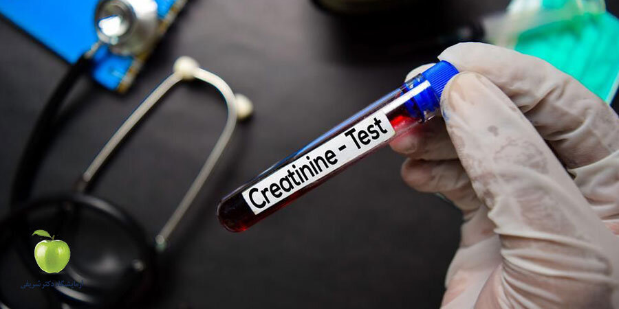 تفسیر نتایج آزمایش کراتینین