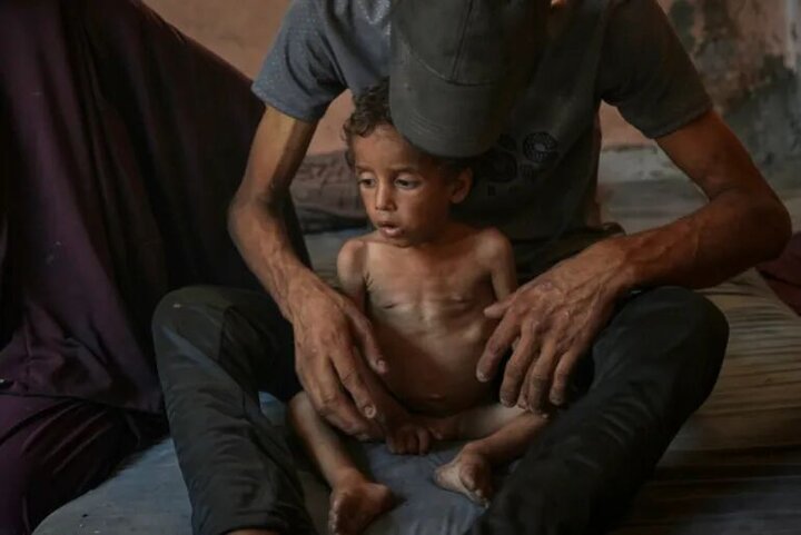 شهادت ۲۲۷ نفر در غزه به دلیل گرسنگی و سوء تغذیه