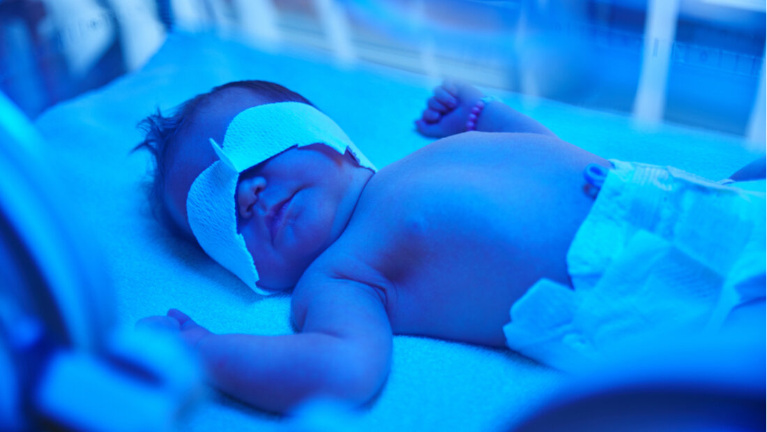 Elevated Bilirubin in Newborns Poses Serious Neurological Risks